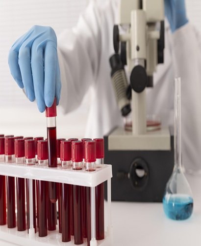 Hematology & Coagulation Reagents